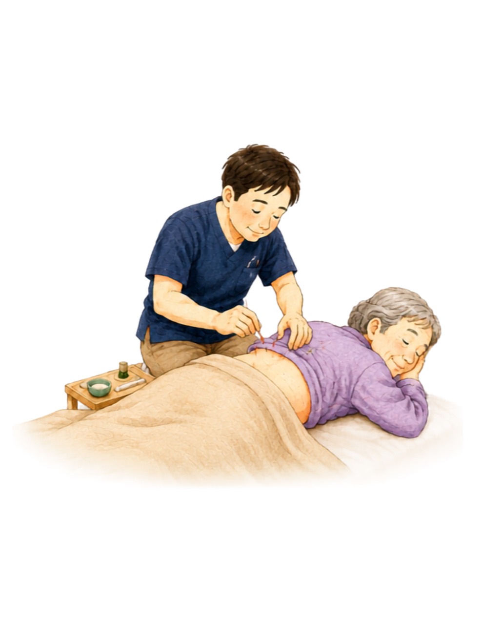 ご自宅で利用者の腰に鍼を行う訪問鍼灸のイラスト